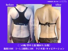 フェレザ 新潟(Felleza)/どうしても痩せたい方へ！