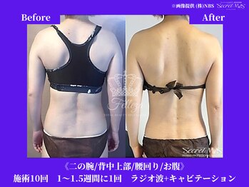 フェレザ 新潟(Felleza)/どうしても痩せたい方へ！