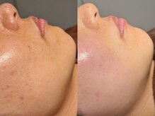 ルーナジェーナ(Luna llena)/池袋　エステ　ルーナジェーナ