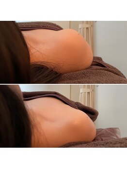 キサラ(Kisara)/首・肩もスッキリ!! 巻肩改善