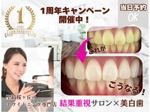 ホワイトニングショップ 多摩店