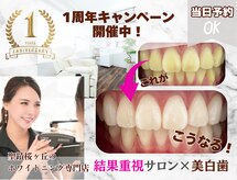 ホワイトニングショップ 多摩店