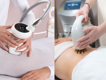 ビューティーリバース センター北店の写真/【センター北駅すぐ】最新＆業界最高峰マシンが勢揃い！エンダモロジー/サーモ・シェイプ/納得の結果へ！