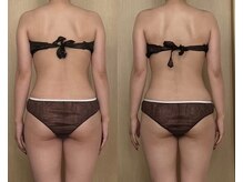 モモリラ(momorila)/活性リンパ洗浄