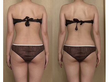 モモリラ(momorila)/活性リンパ洗浄