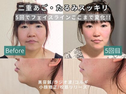 カンワ美容鍼灸院(KANWA美容鍼灸院)の写真