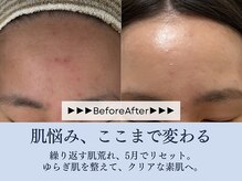 サロン コムモア(salon COMME MOI)