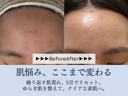 サロン コムモア(salon COMME MOI)の写真