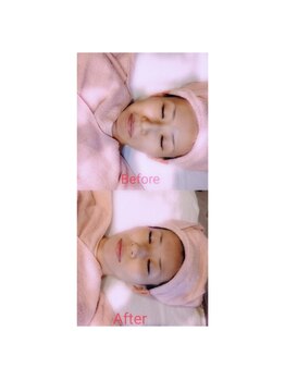 イーエムプレイス(EM;Place)/