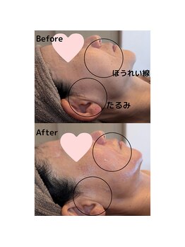 サロン ド ベルメール(Salon de Belle mer)/小顔美筋マッサージ/小顔/リンパ