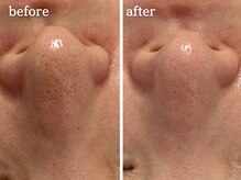 メルシア(merucia)/