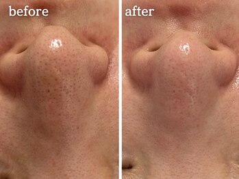 メルシア(merucia)/