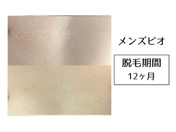 メンズビオ 神戸三宮店/