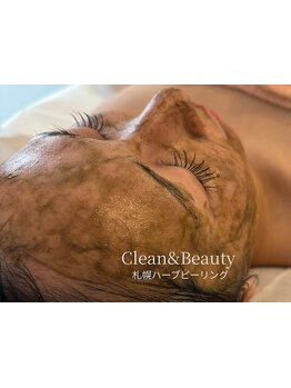 ハリツヤをUPしたい