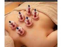 青空指圧治療院/カッピングで背中のコリほぐし