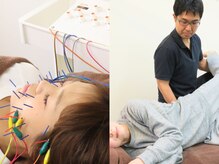 マッチ鍼灸整骨院/顔も体も整う【美容鍼×整体】