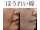 Nビューティーの写真