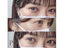 トリコアイ 梅田茶屋町店(trico Eye)/ぱっちりお目目へ！