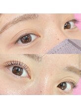アイサロン アンドアン(eye salon &anne)/ぱっちりeye