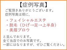 ひかり素肌/症例写真について