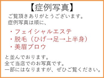 ひかり素肌/症例写真について