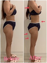 スペチアーレ 夙川/全身ボディハイリフ