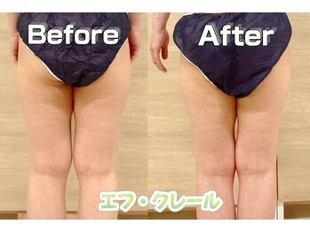 エフクレール(Ef Clair)/スロータス施術ビフォーアフター