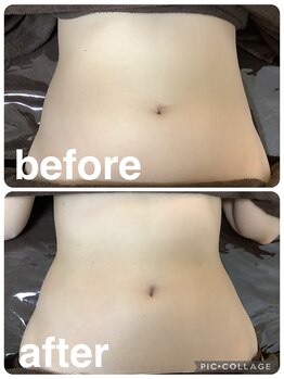 ギンザアール(GINZA R.)/くびれ爆誕◎