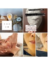 ブルーム(B.LOOM)/引き上げ（リフトアップ）