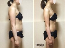 ノットノット 自由が丘(Not Knot)の雰囲気（WINBACK（ウィンバック）×リンパストレッチ/ブライダル/痩身）