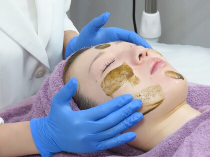 ディンプル(Dimple)の写真