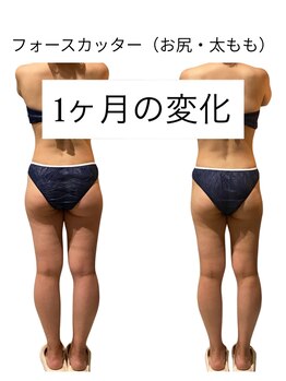 ビーアイリー(Be irie)/痩身エステ フォースカッター