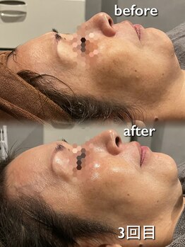 リイル バイ クレビア(REILE by Crebia)/お客様写真