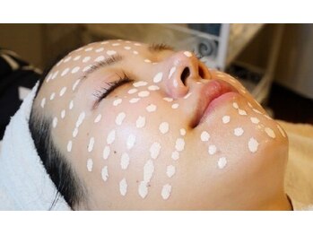 サロンマリー(SALON MARIE)の写真/【最新の肌育トリートメント】話題のMSCメソスキンカラーで思わず見惚れる透明感溢れる理想の素肌に◎