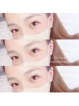 リヨン(LYON+831)/