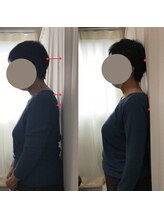 蕨整体院/姿勢矯正/猫背/肩こり/腰痛/整体