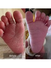 ナナラ(NANALA)/新生児の赤ちゃんも使える