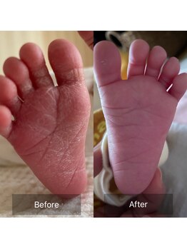 ナナラ(NANALA)/新生児の赤ちゃんも使える