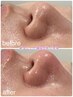   韓国式ごっそり【毛穴洗浄】！　顔全体の毛穴をキレイにして小顔へ導く