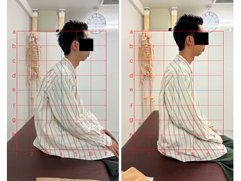 トワニ整体 新富町院(TOWANI整体)/首こり/銀座/新富町/築地/整体
