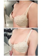 カナエルサロン 旭川(KANAERU SALON)/【バストアップ症例】