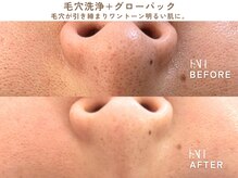 ファン(FAN)/グローパック BEFORE-AFTER