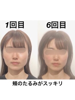 経堂鍼灸整体院/幸せな日に向けたお手伝い