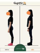 ジップス(Gyp3S=)/反り腰・もも張りもも改善！