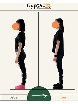 ジップス(Gyp3S=)/反り腰・もも張りもも改善！