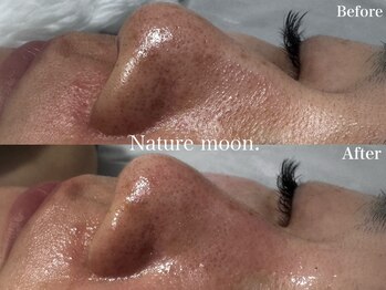 ナチュールムーン(Nature moon.)/毛穴洗浄