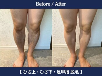 ランドマーク 中崎町(LANDMARK.)/《 足 》