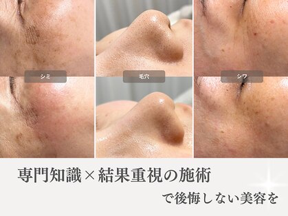 レイミー(reimee)の写真