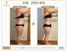 ドクタースタイル(Dr.style)/41歳23回の変化