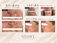ストーリィ バイ サトミスキンケアスタジオ(STORY. by satomi skincare studios)